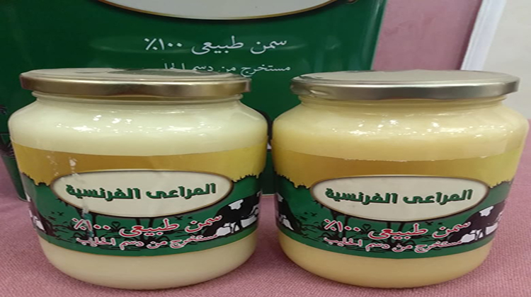 سمنة